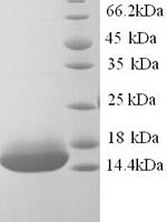 Human Cyclin-J-like protein (CCNJL), partial Recombinant Protein - BioCrest Sci