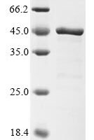 Human F-box only protein 4 (FBXO4) Recombinant Protein - BioCrest Sci
