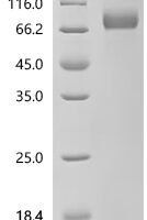 Mouse Interferon alpha/beta receptor 2 (Ifnar2), Biotinylated Recombinant Protein - BioCrest Sci