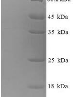 Mouse C-C motif chemokine 3 (Ccl3) Recombinant Protein - BioCrest Sci