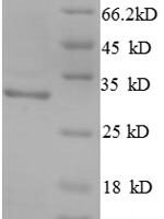 Alternaria alternata Superoxide dismutase [Mn], mitochondrial, partial Recombinant Protein - BioCrest Sci