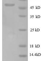 Human Oncostatin-M (OSM), partial Recombinant Protein, N-GST - BioCrest Sci