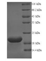 Human Probable G-protein coupled receptor 75 (GPR75), partial Recombinant Protein - BioCrest Sci