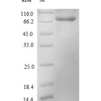 Escherichia coli Probable phosphatidylethanolamine transferase Mcr-1 (mcr1) Recombinant Protein - BioCrest Sci