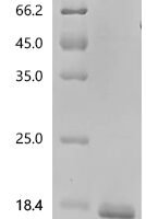 Human Heparanase (HPSE), partial Recombinant Protein, C-His - BioCrest Sci