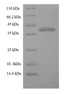 Human Charged multivesicular body protein 5 (CHMP5) Recombinant Protein, Homo sapiens (Human), E.coli, N-terminal 6xHis-SUMO-tagged, 40.6 kDa, purity >≥ 90% as determined by SDS-PAGE.
