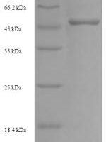 Mouse Homeobox protein Nkx-2.2 (Nkx2-2) Recombinant Protein - BioCrest Sci