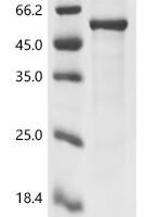Gibbon ape leukemia virus Envelope glycoprotein (env), partial Recombinant Protein - BioCrest Sci