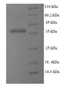 Human Dihydrofolate reductase (DHFR), partial Recombinant Protein, Homo sapiens (Human), E.coli, N-terminal 6xHis-SUMO-tagged, 37.3 kDa, purity >≥ 90% as determined by SDS-PAGE.