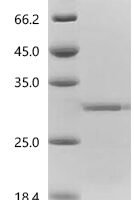 Human Calcium/manganese antiporter SLC30A10 (SLC30A10), partial Recombinant Protein - BioCrest Sci