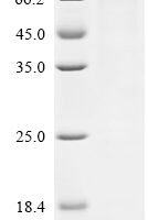 Mouse Semaphorin-3G (Sema3g) Recombinant Protein, C-His - BioCrest Sci