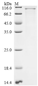 Mouse Semaphorin-3G (Sema3g) Recombinant Protein, C-His, Mus musculus (Mouse), E.coli, C-terminal 6xHis-tagged, 91.3 kDa, purity >≥ 85% as determined by SDS-PAGE.
