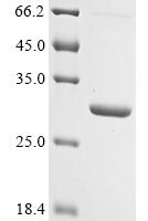 Bovine Prolactin (PRL) Recombinant Protein, N-10His/C-Myc - BioCrest Sci