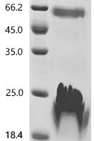 Human DnaJ homolog subfamily B member 6 (DNAJB6) Recombinant Protein, C-His, aa 2–241, Yeast - BioCrest Sci