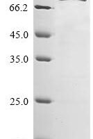 Rat Tripartite motif-containing protein 2 (Trim2) Recombinant Protein - BioCrest Sci