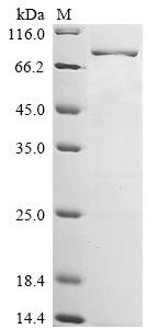 Rat Tripartite motif-containing protein 2 (Trim2) Recombinant Protein, Rattus norvegicus (Rat), E.coli, N-terminal 6xHis-tagged, 85.5 kDa, purity >≥ 85% as determined by SDS-PAGE.