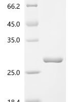 Abrus precatorius Abrin-c, partial Recombinant Protein - BioCrest Sci