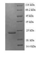 Human Fractalkine (CX3CL1), partial Recombinant Protein - BioCrest Sci