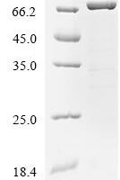 Bordetella pertussis Pertussis toxin subunit 1 (ptxA), Biotinylated Recombinant Protein - BioCrest Sci