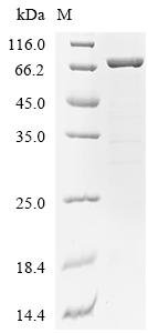 Bordetella pertussis Pertussis toxin subunit 1 (ptxA), Biotinylated Recombinant Protein, Bordetella pertussis (strain Tohama I / ATCC BAA-589 / NCTC 13251), E.coli, N-terminal MBP-tagged and C-terminal 6xHis-Avi-tagged, 74.0 kDa, purity >≥ 85% as determined by SDS-PAGE.