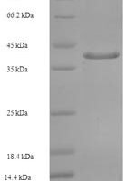 Human Golgi SNAP receptor complex member 2 (GOSR2), partial Recombinant Protein - BioCrest Sci