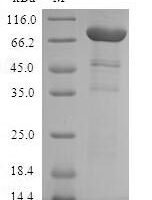 Human Aryl-hydrocarbon-interacting protein-like 1 (AIPL1) Recombinant Protein, N-GST - BioCrest Sci