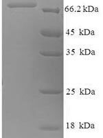 Human Nuclear RNA export factor 3 (NXF3) Recombinant Protein - BioCrest Sci