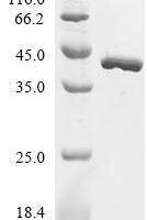 Escherichia coli Elongation factor Ts (tsf) Recombinant Protein - BioCrest Sci