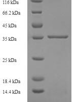 Human Interleukin-29 (IL29), partial Recombinant Protein - BioCrest Sci