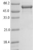 Human Translation initiation factor IF-3, mitochondrial (MTIF3) Recombinant Protein - BioCrest Sci