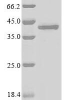 Mouse Alpha-2-macroglobulin receptor-associated protein (Lrpap1), partial Recombinant Protein, N-GFP/C-His, aa 248–360 (H294F,H296F,Y297C,H305F), Baculovirus - BioCrest Sci