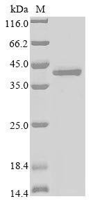 Mouse Alpha-2-macroglobulin receptor-associated protein (Lrpap1), partial Recombinant Protein, N-GFP/C-His, aa 248–360 (H294F,H296F,Y297C,H305F), Baculovirus, Mus musculus (Mouse), Baculovirus, N-terminal GFP-tagged and C-terminal 6xHis-tagged, 42 kDa, purity >≥ 85% as determined by SDS-PAGE.