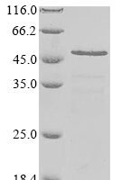 Toxoplasma gondii Dense granule protein 6 (GRA6), partial Recombinant Protein - BioCrest Sci
