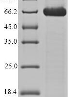 Human CD166 antigen (ALCAM), partial Recombinant Protein - BioCrest Sci