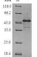 Human Heat shock protein beta-2 (HSPB2) Recombinant Protein - BioCrest Sci