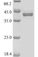 Mouse Alpha-2-macroglobulin receptor-associated protein (Lrpap1), partial Recombinant Protein, N-GFP/C-His - BioCrest Sci
