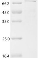 Human FERM domain containing 5 (FRMD5) Recombinant Protein, C-His - BioCrest Sci