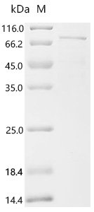Human FERM domain containing 5 (FRMD5) Recombinant Protein, C-His, Homo sapiens (Human), E.coli, C-terminal 6xHis-tagged, 65.4 kDa, purity >≥ 85% as determined by SDS-PAGE.