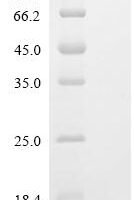 Mouse Serum amyloid A-2 protein（Saa2) Recombinant Protein - BioCrest Sci