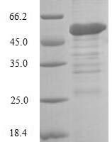 Human Baculoviral IAP repeat-containing protein 8 (BIRC8) Recombinant Protein - BioCrest Sci