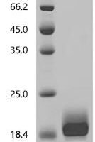 Macaca mulatta Interleukin-2 (IL2) Recombinant Protein, N-10His - BioCrest Sci