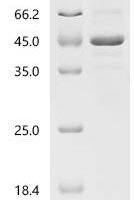 Human Galactose-1-phosphate uridylyltransferase (GALT) Recombinant Protein, C-His, aa 1–379, Homo sapiens (Human) - BioCrest Sci