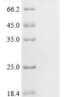 Human Disks large homolog 4 (DLG4) Recombinant Protein, C-hFc1 - BioCrest Sci