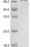 Cat Zona pellucida sperm-binding protein 3 (ZP3) Recombinant Protein, C-hFc1 - BioCrest Sci