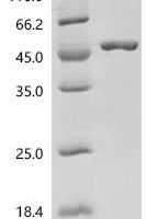 Mycoplasma genitalium Uncharacterized protein MG281 (MG281), partial Recombinant Protein, C-His, aa 74–468 - BioCrest Sci