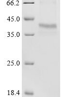 Human U1 small nuclear ribonucleoprotein A (SNRPA) Recombinant Protein, C-His - BioCrest Sci