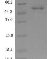 Human Cleavage and polyadenylation specificity factor subunit 4 (CPSF) Recombinant Protein - BioCrest Sci