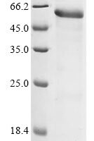 Human Adenomatous polyposis coli protein (APC), partial Recombinant Protein - BioCrest Sci