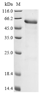 Human Adenomatous polyposis coli protein (APC), partial Recombinant Protein, Homo sapiens (Human), E.coli, N-terminal 10xHis-tagged and C-terminal Myc-tagged, 49.8 kDa, purity >≥ 85% as determined by SDS-PAGE.