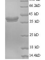 Human Ubiquitin-like FUBI-ribosomal protein eS30 fusion protein (FAU) Recombinant Protein, N-GST - BioCrest Sci